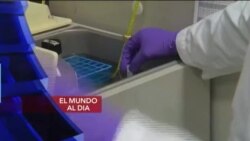 El Mundo al día
