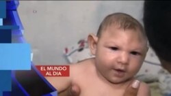 El Mundo al día